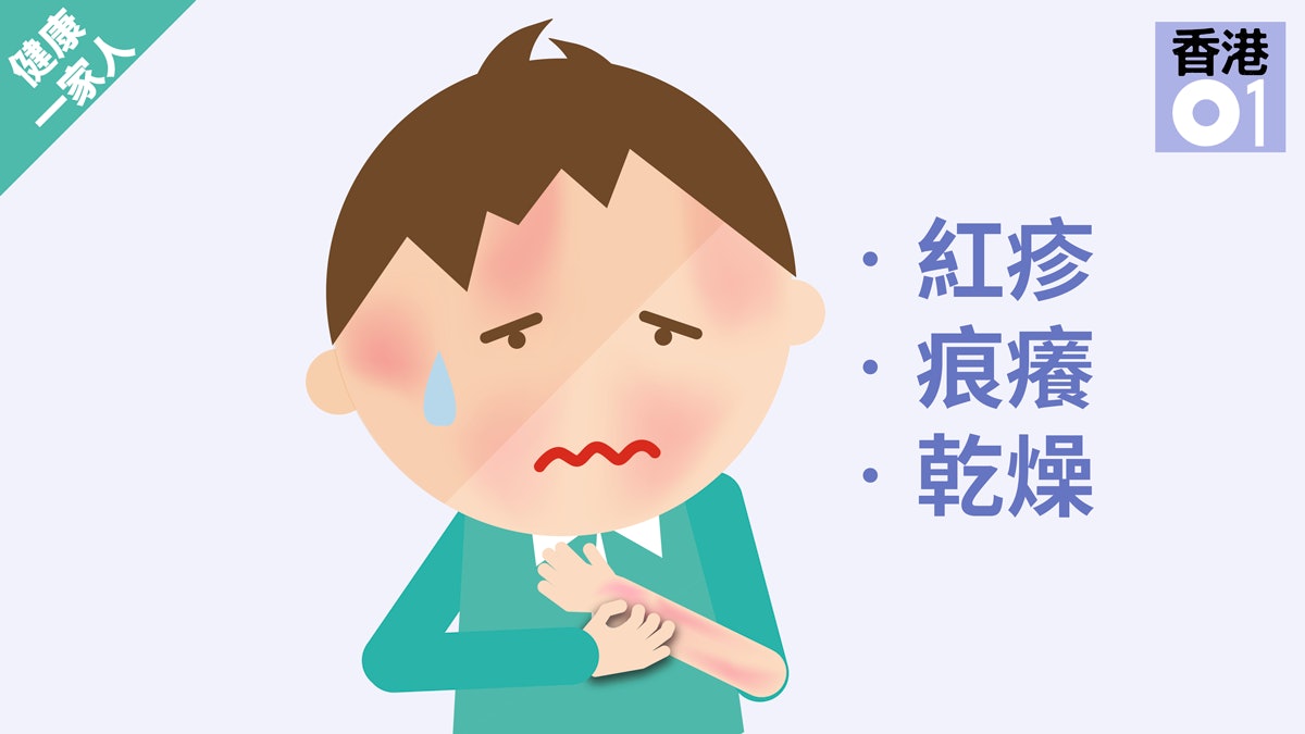 【健康一家人】夏日常見皮膚病 4招預防風癩濕疹 【健康一家人】夏日常見皮膚病 4招預防風癩濕疹