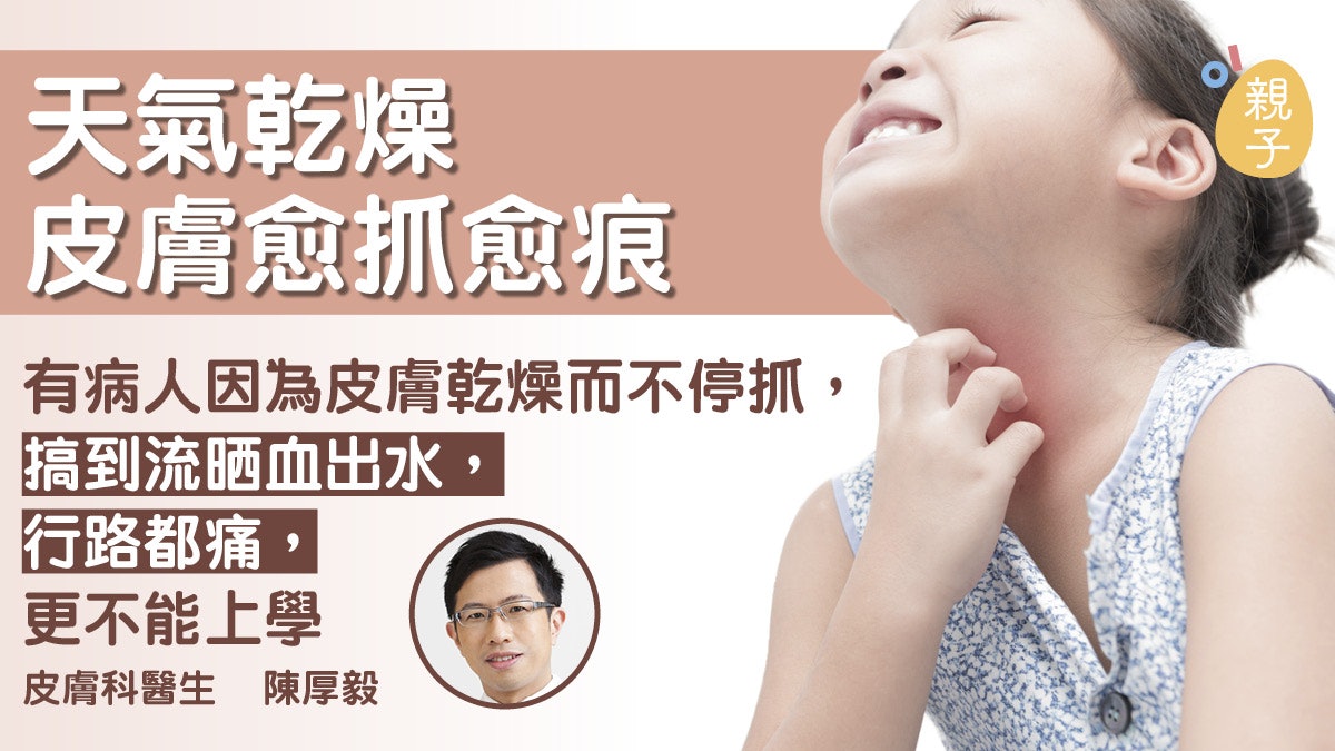 【周身痕點算好】皮膚乾燥痕癢難耐 醫生教你三招防痕滋潤法 【周身痕點算好】皮膚乾燥痕癢難耐 醫生教你三招防痕滋潤法