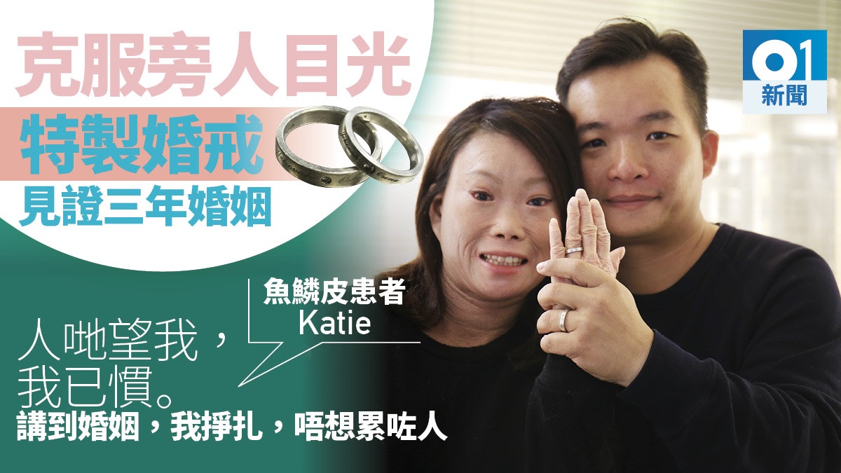 魚鱗下的愛 魚鱗皮患者遇暖男曾怕結婚累對方仍勇敢愛下去 魚鱗下的愛 魚鱗皮患者遇暖男曾怕結婚累對方仍勇敢愛下去