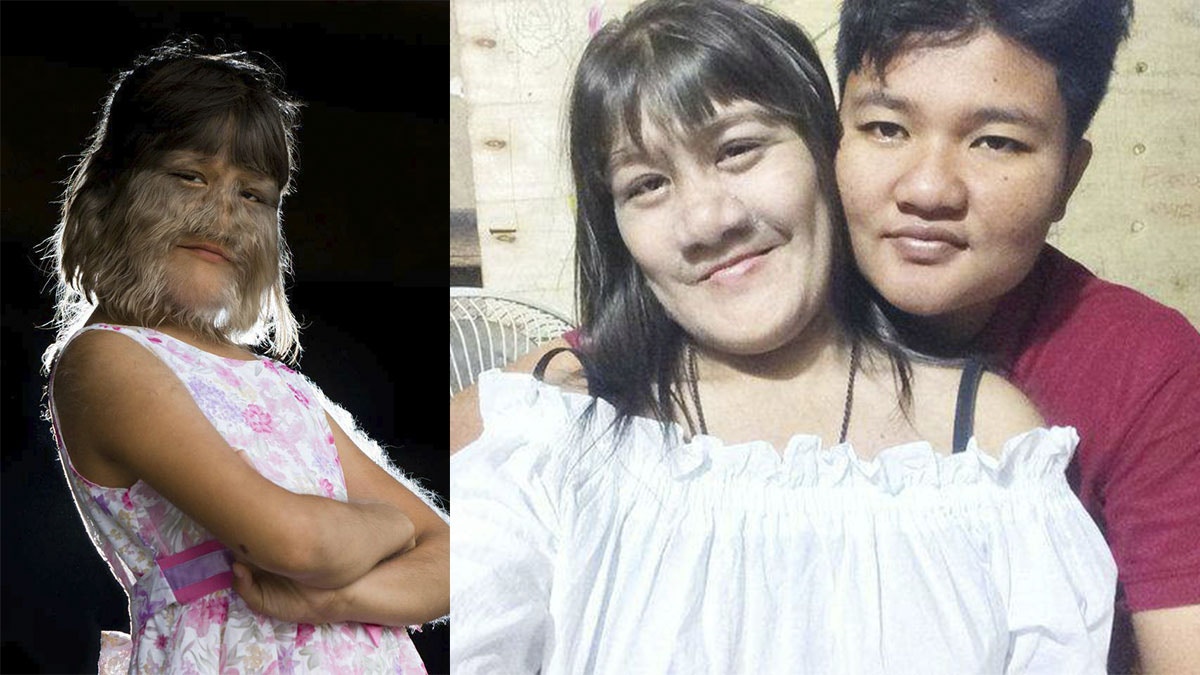 「世上最多毛女孩」17歲素素樊結婚　剃毛露清秀真貌fb放閃