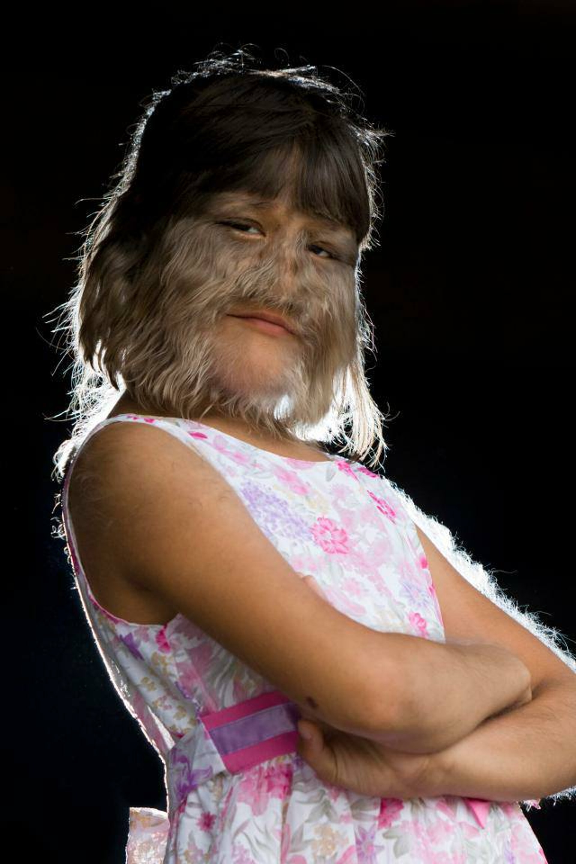 素素樊獲健力士世界紀錄認證為「世上最多毛女孩」,她患極罕見的「狼人症候群」遺傳疾病,身上及臉長都滿毛。(Sumatra Susuphan fb圖片) 素素樊獲健力士世界紀錄認證為「世上最多毛女孩」,她患極罕見的「狼人症候群」遺傳疾病,身上及臉長都滿毛。(Sumatra Susuphan fb圖片)