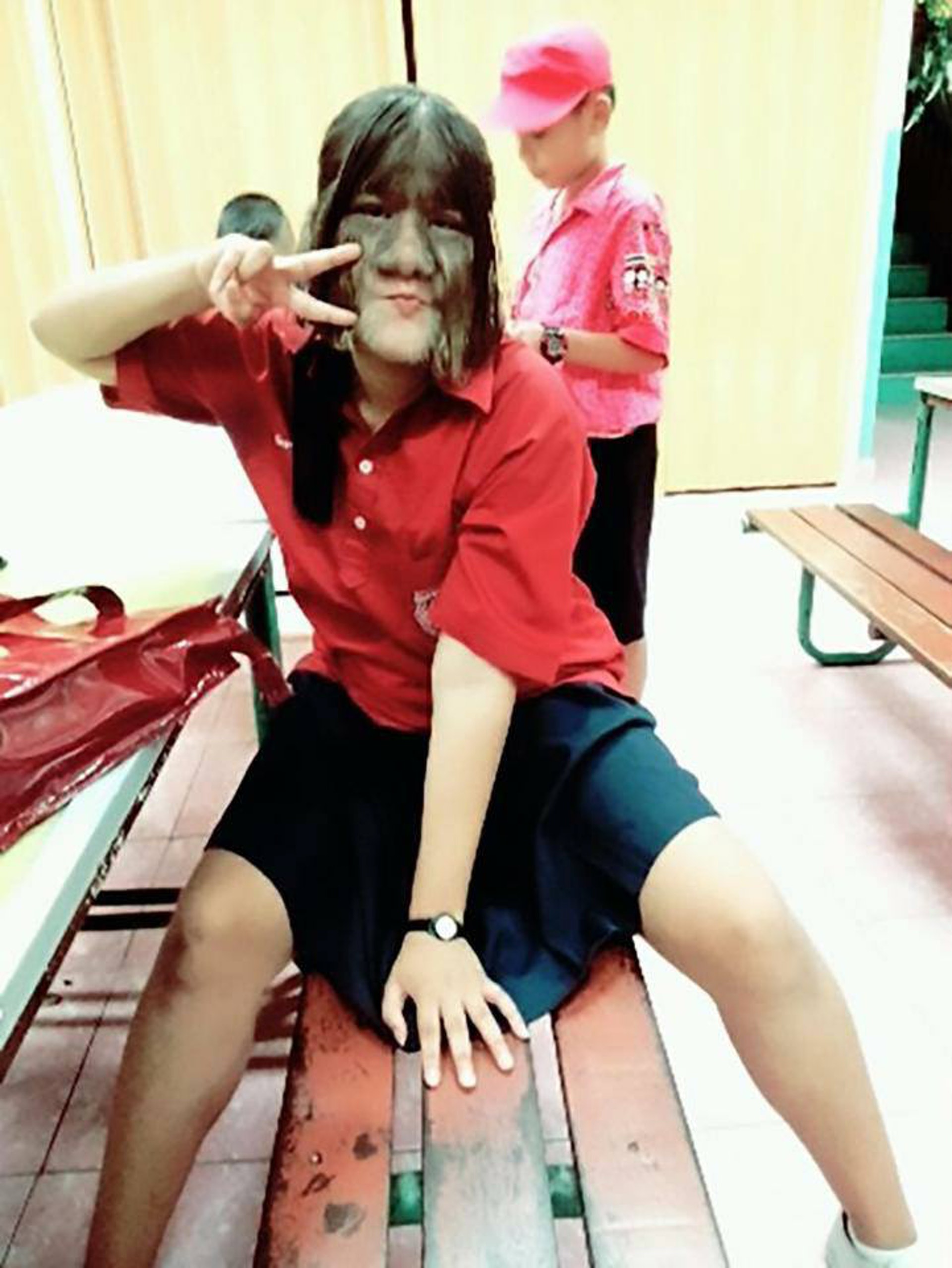 素素樊獲健力士世界紀錄認證為「世上最多毛女孩」,她患極罕見的「狼人症候群」遺傳疾病,身上及臉長都滿毛。(Sumatra Susuphan fb圖片) 素素樊獲健力士世界紀錄認證為「世上最多毛女孩」,她患極罕見的「狼人症候群」遺傳疾病,身上及臉長都滿毛。(Sumatra Susuphan fb圖片)