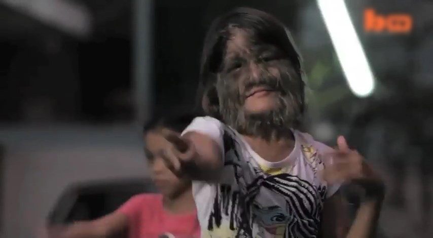 素素樊2010年獲健力士世界紀錄認證為「世上最多毛女孩」，但她總是開朗樂觀地生活。（Barcroft TV片段截圖）