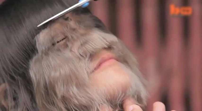 素素樊2010年獲健力士世界紀錄認證為「世上最多毛女孩」，不時由媽媽幫她修剪臉上毛髮。（Barcroft TV片段截圖）