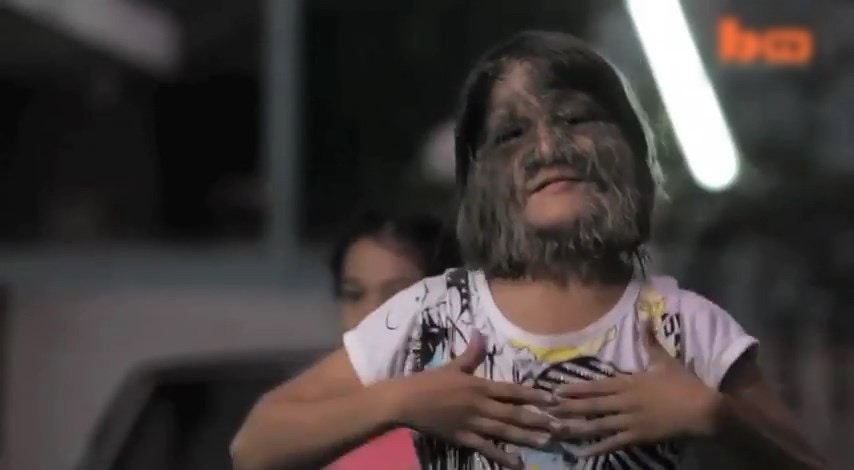 素素樊2010年獲健力士世界紀錄認證為「世上最多毛女孩」。（Barcroft TV片段截圖）