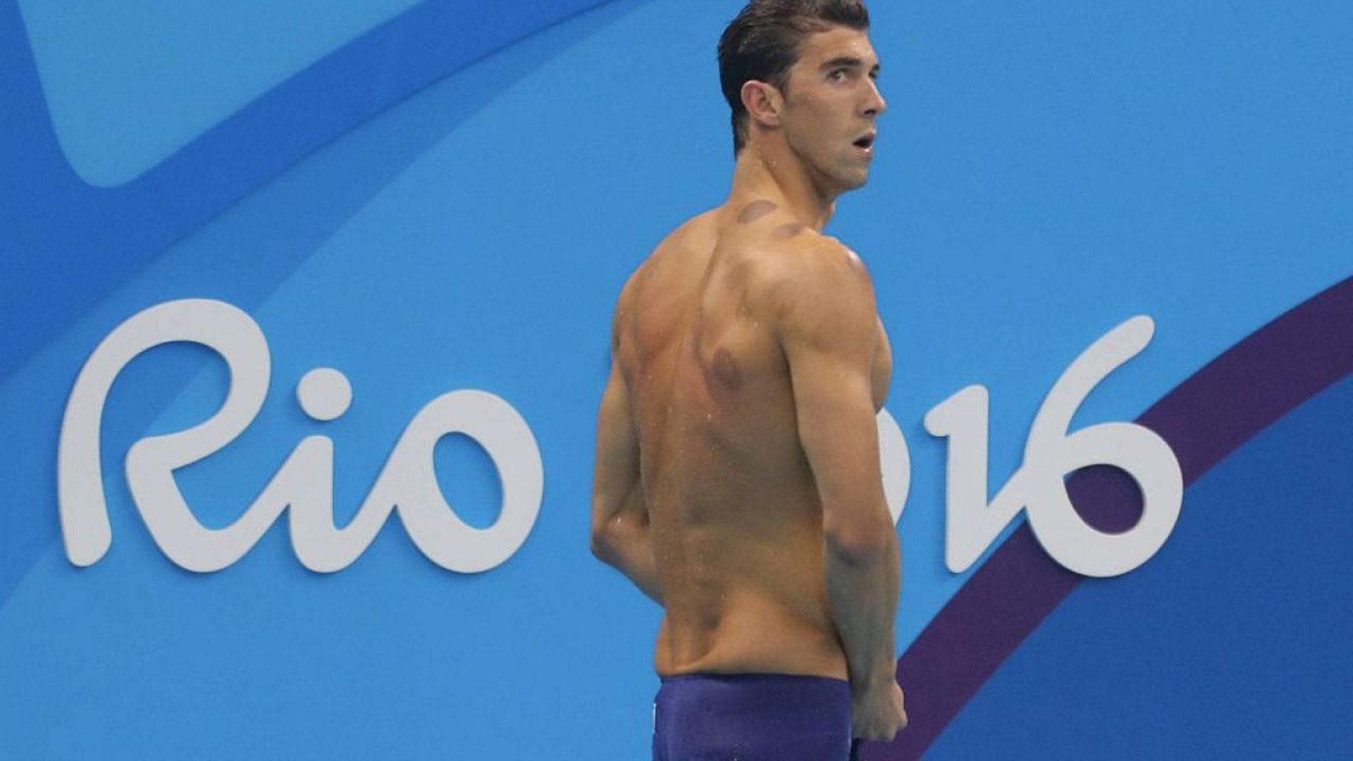 上屆奧運時，泳手菲比斯背後的拔罐印引起不少討論，而且菲比斯本人非常受落，認為甚為有效。（資料圖片）