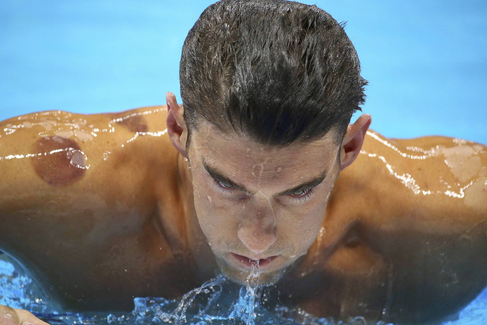 上屆奧運時，泳手菲比斯背後的拔罐印引起不少討論，而且菲比斯本人非常受落，認為甚為有效。（視覺中國）