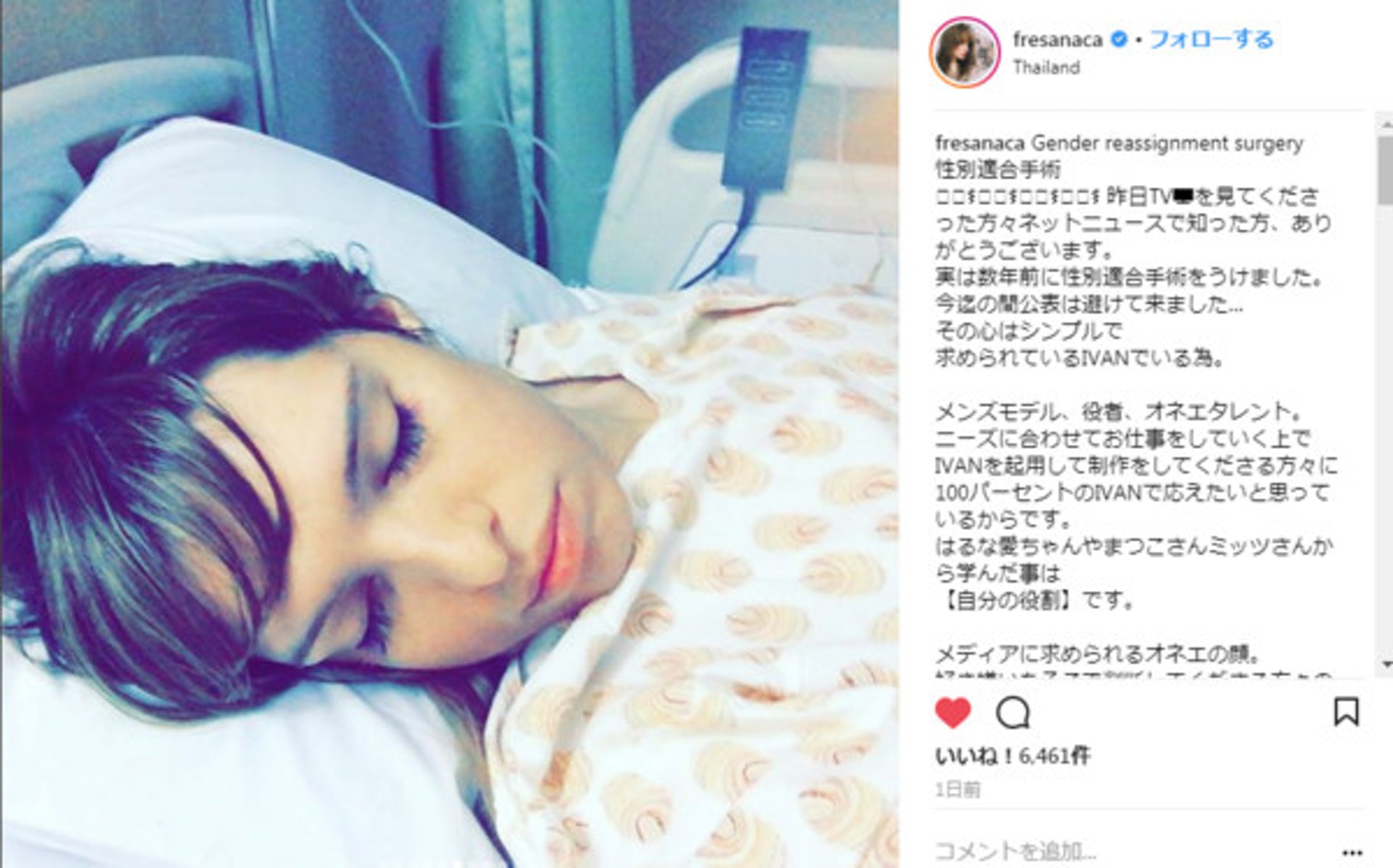 日本模特兒Ivan本月7日公開自己已變性,並上載躺在病床上的照片。(「fresanaca」ig圖片) 日本模特兒Ivan本月7日公開自己已變性,並上載躺在病床上的照片。(「fresanaca」ig圖片)