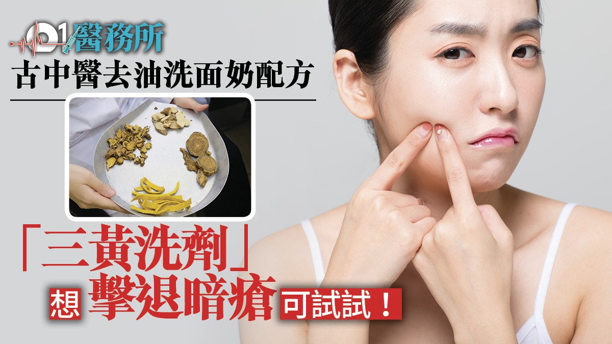 【解決面油暗瘡】潮濕天氣易濕重 疲倦面油多 中西醫教護膚食療 【解決面油暗瘡】潮濕天氣易濕重 疲倦面油多 中西醫教護膚食療