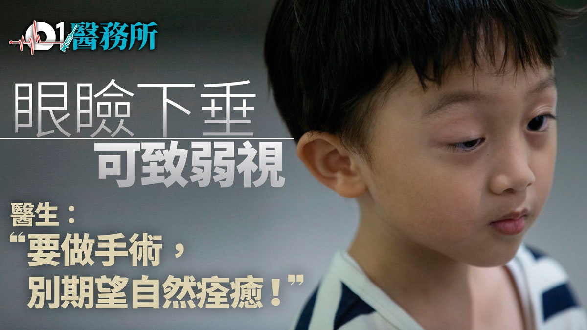 兒童大細眼、恰眼瞓? 或屬先天性眼瞼下垂 6歲做手術效果較佳