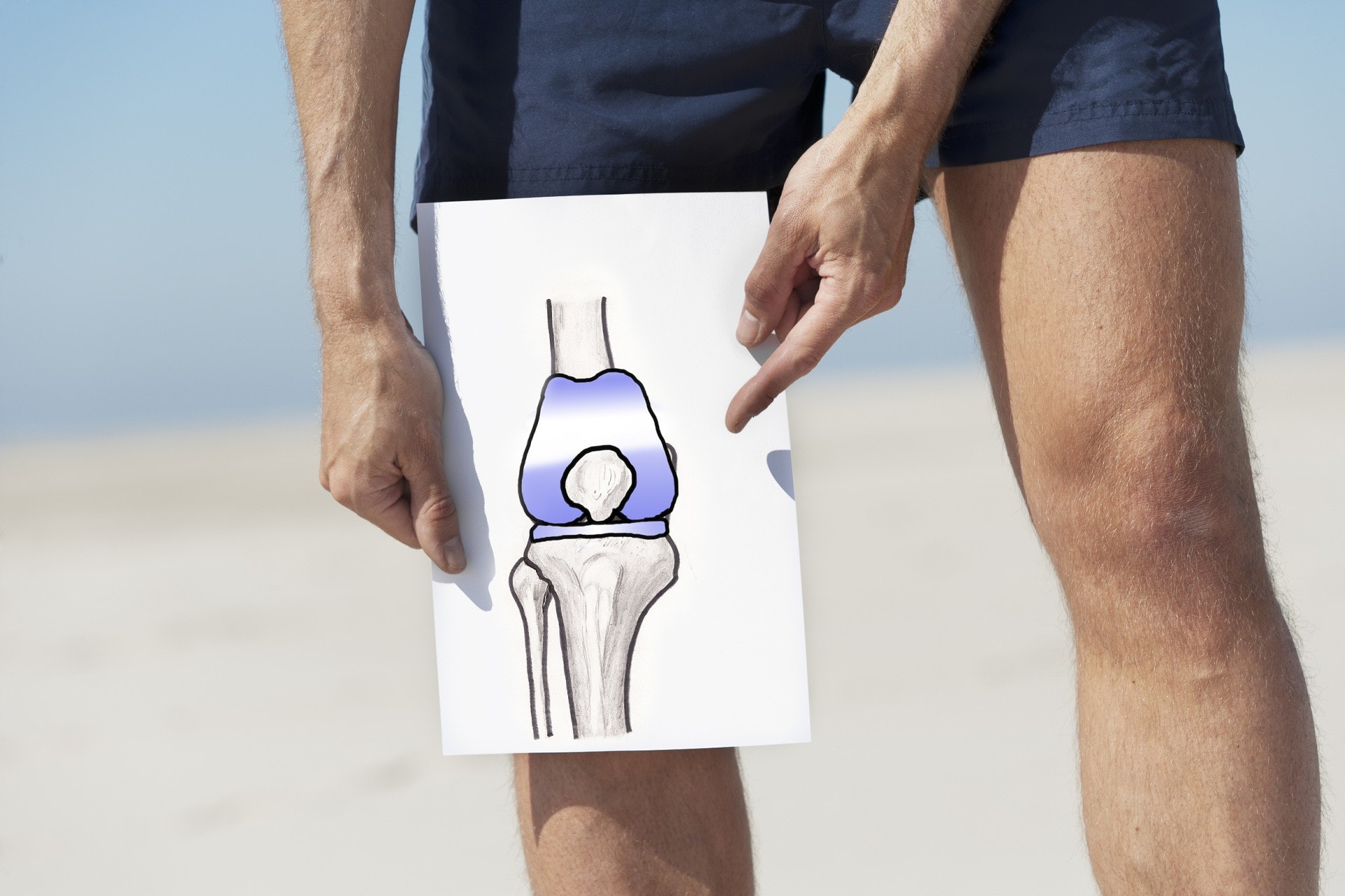 關節名醫呂紹睿指出，膝關節「退化」與年齡的關係並不是直接的，軟骨的破壞是從年輕就開始，發病年齡與膝關節不當使用的強度以及頻率有關。（視覺中國）