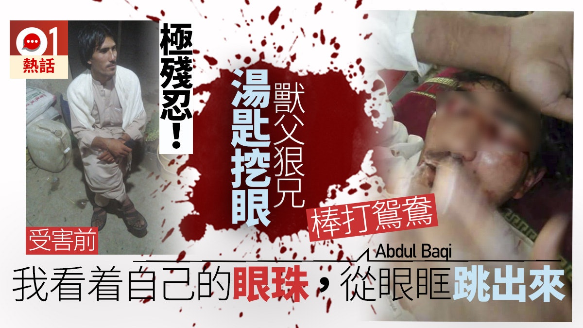慘!挖出雙眼剁碎 青年要娶「愛手機聊天女友」 禽獸父兄施酷刑 慘!挖出雙眼剁碎 青年要娶「愛手機聊天女友」 禽獸父兄施酷刑