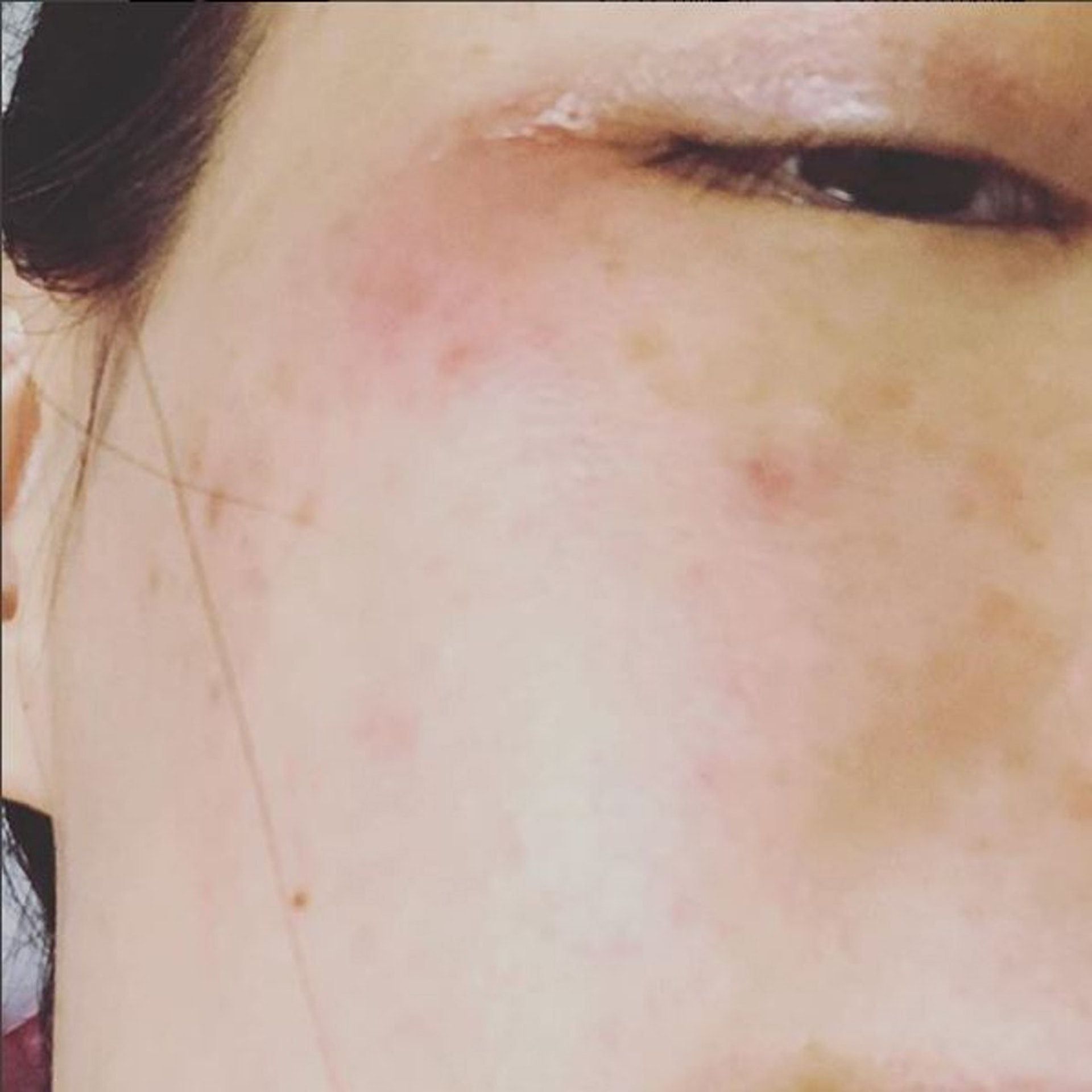 敏感肌令不少人十分困擾。(舒淇Instagram) 敏感肌令不少人十分困擾。(舒淇Instagram)