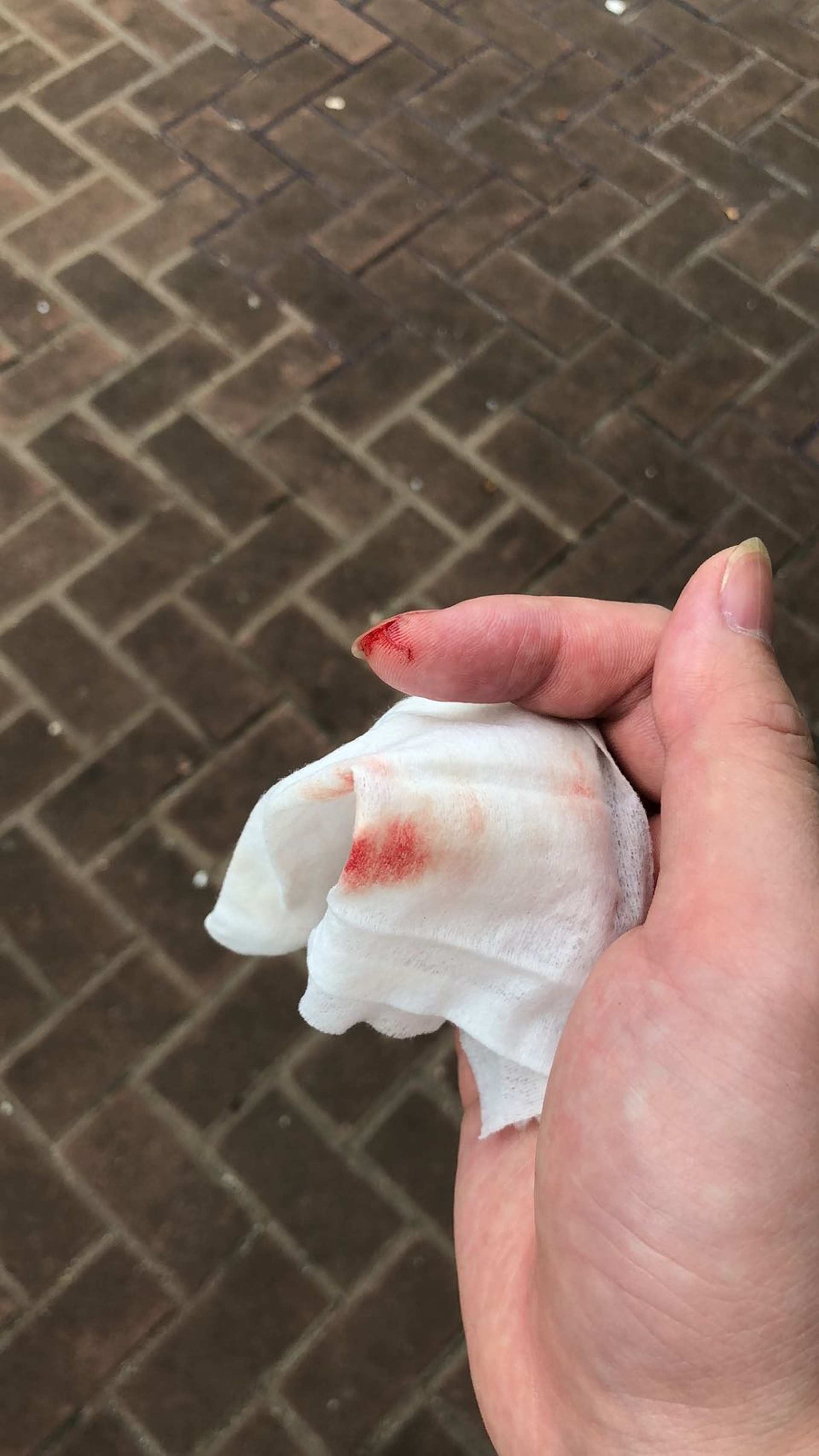 馬小姐的朋友被受驚的小貓咬傷。（馬小姐提供）