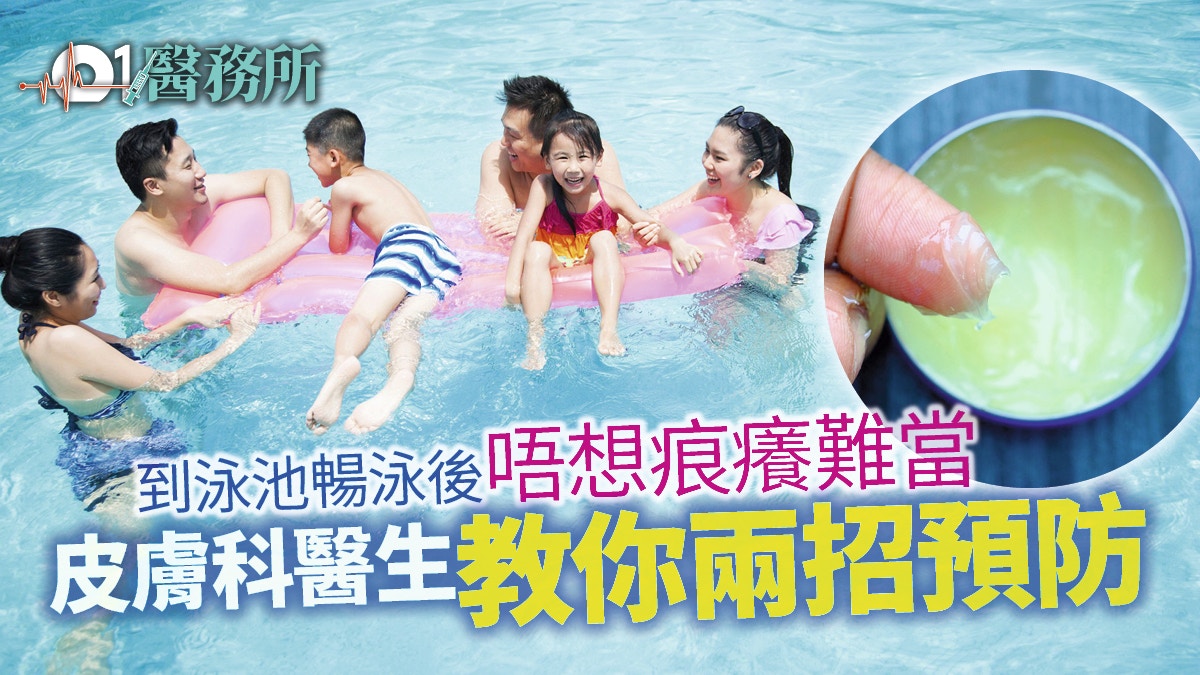 泳池暢泳後周身痕又出疹　原來對氯氣敏感　皮膚科醫生教處理方法