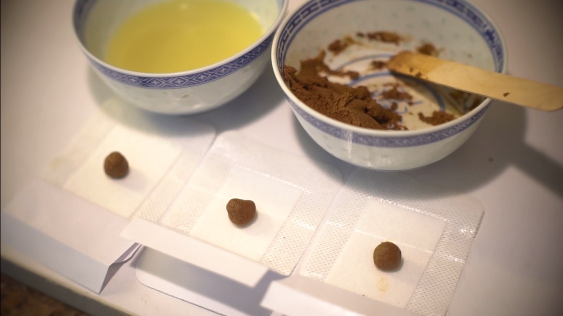 【天灸療法】研製「三伏貼」過程大公開 記者親身試