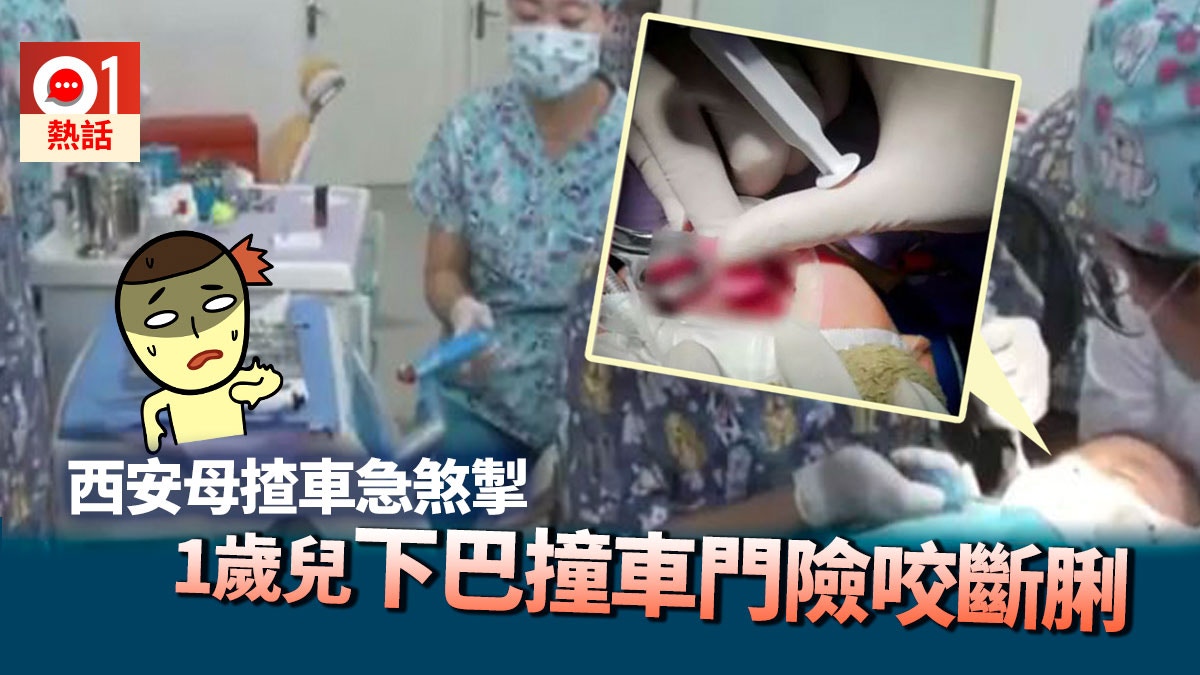 兩幼兒坐後座無安全座椅　西安母掟彎急剎車　1歲B幾乎咬斷脷