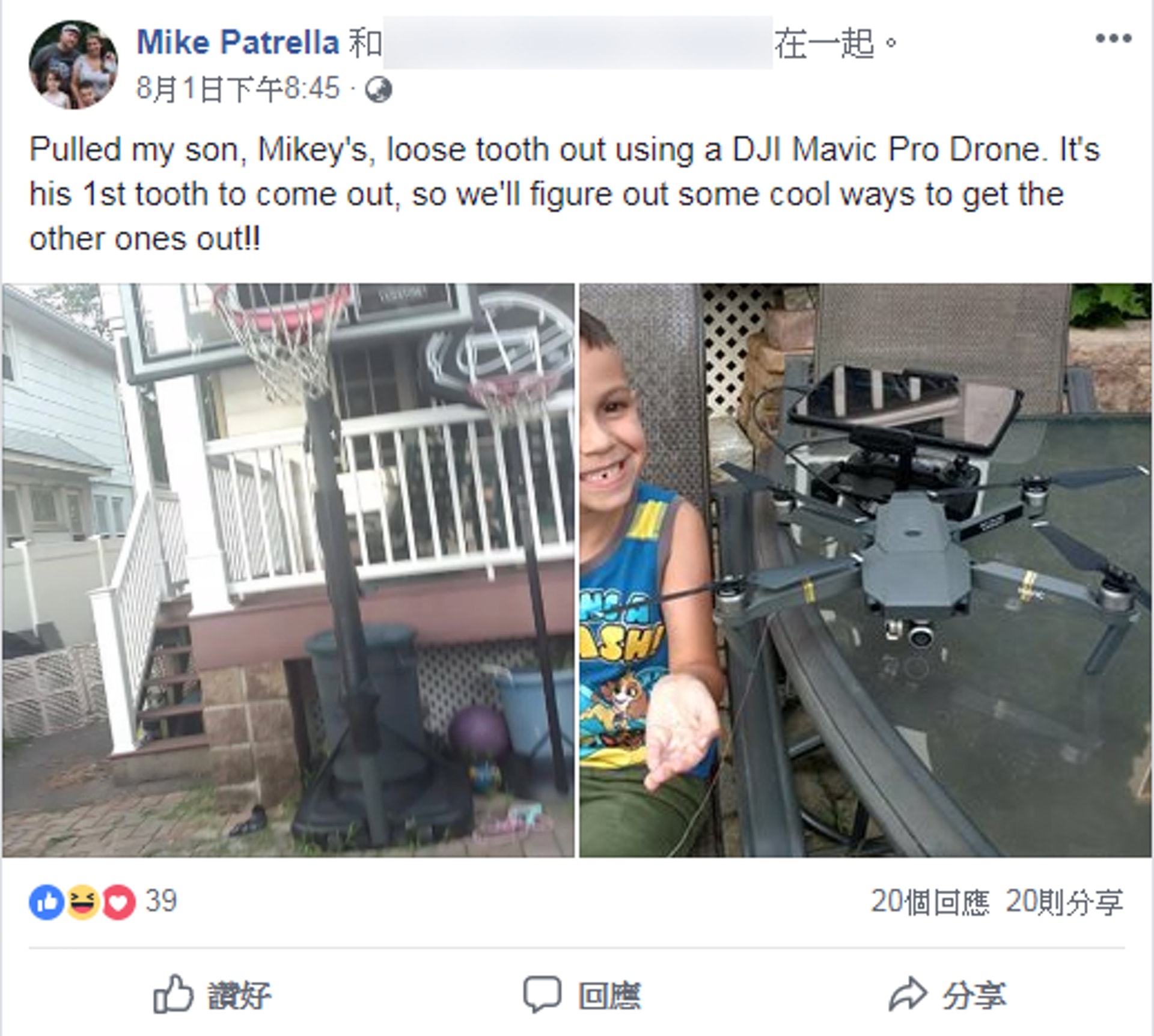 美國一名爸爸用線將兒子的乳齒和航拍機綁上,以航拍機升空的力量為兒子拔掉首隻乳齒,影片被網民瘋傳。(fb「Mike_Patrella」截圖) 美國一名爸爸用線將兒子的乳齒和航拍機綁上,以航拍機升空的力量為兒子拔掉首隻乳齒,影片被網民瘋傳。(fb「Mike_Patrella」截圖)