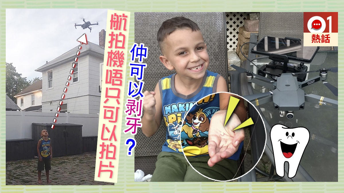 【大陣仗】仔仔將歷第一次甩牙 美國爸爸策動「航拍機剥牙計劃」 【大陣仗】仔仔將歷第一次甩牙 美國爸爸策動「航拍機剥牙計劃」