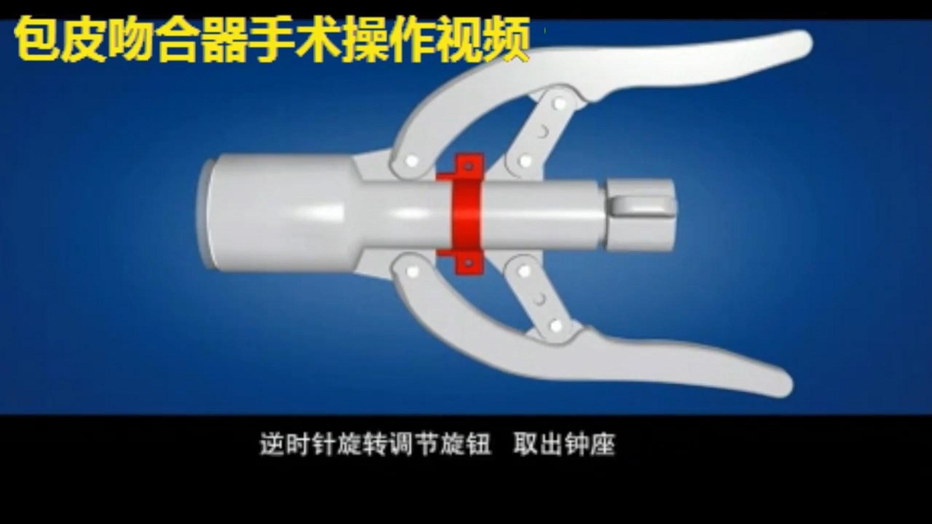 淘寶售DIY割包皮器 悲慘男稱切掉一半 醫生:斷咗駁返都有問題 | LIHKG 討論區