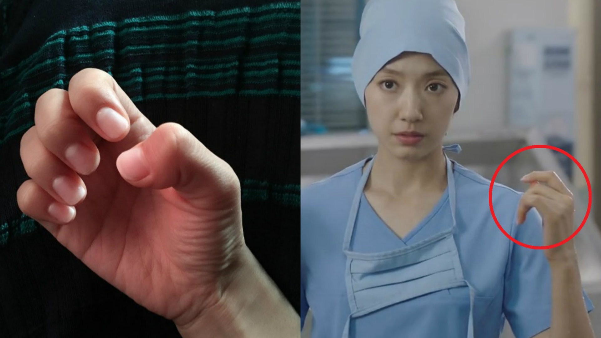 【Doctors】朴信惠Gel甲做手術捱轟 發文自嘲拇指醜 【Doctors】朴信惠Gel甲做手術捱轟 發文自嘲拇指醜