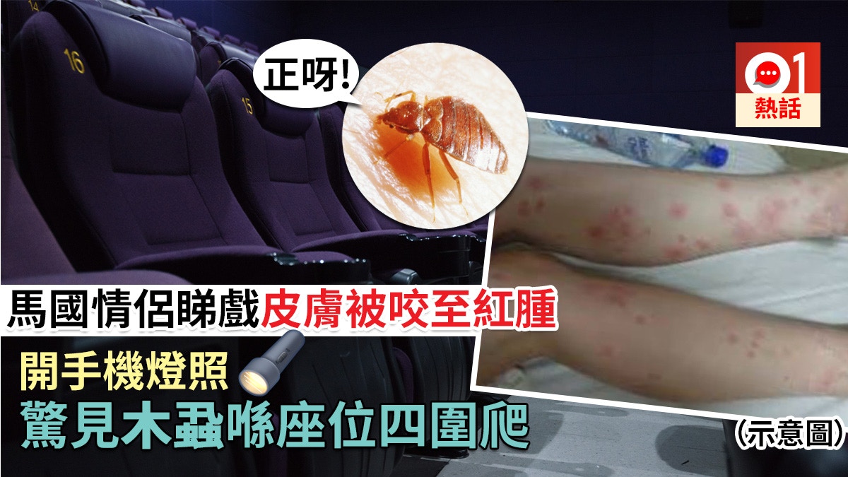 馬國情侶睇戲被蝨狂咬　手腳紅腫疼痛　手機燈照到座位木蝨四圍爬
