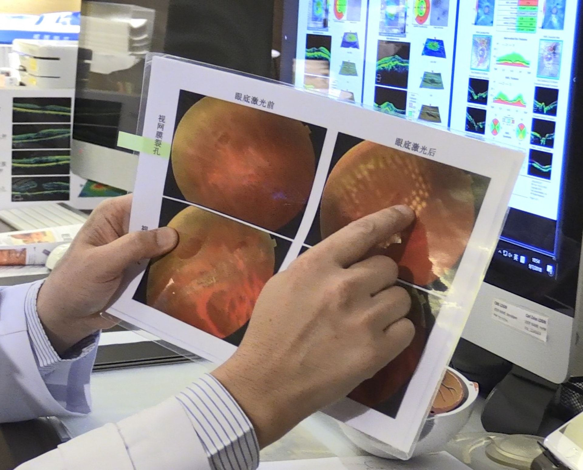 林順潮醫生表示,藍色、紫色太陽鏡片較接近紫外線波長的藍光和紫光,未能有效隔濾紫外線,有可能增加刺激佩戴者眼內黃斑點病變的機會。(溫嘉敏攝)