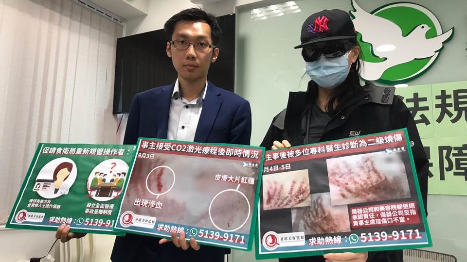 接受激光去肚紋致二級燒傷袁海文促政府立法監管醫療儀器 香港01 政情 接受激光去肚紋致二級燒傷袁海文促政府立法監管醫療儀器 香港01 政情