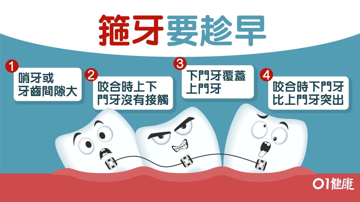 【箍牙】隱形牙箍內箍5類各有優劣　牙周病蛀牙或因「亂牙」所致