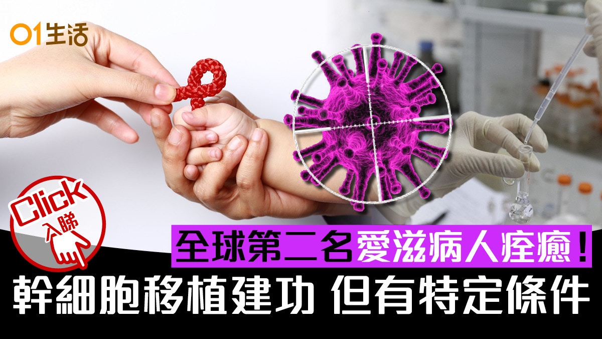【愛滋病有救？】全球第二名愛滋病人痊癒！有特定條件可廣泛用？