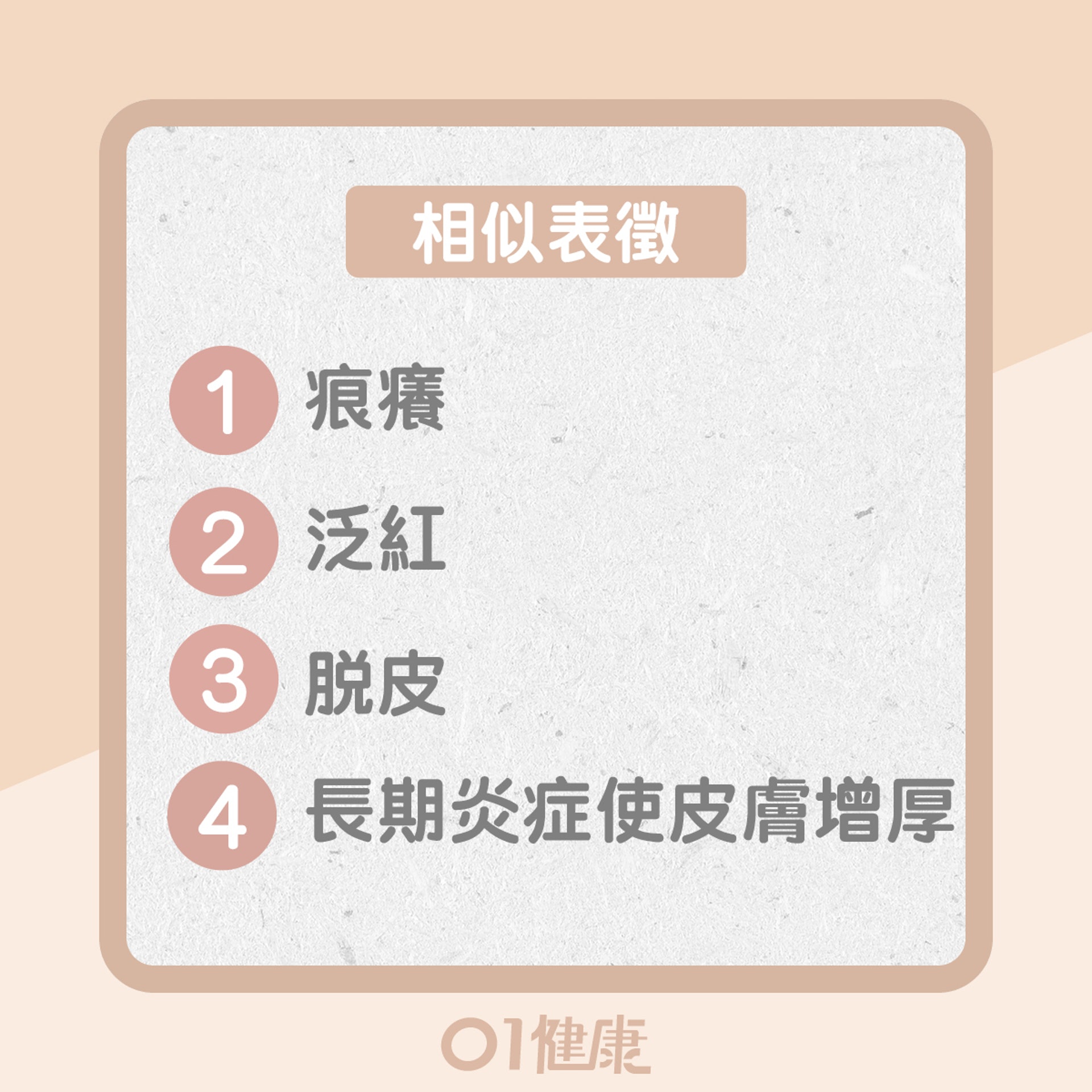異位性皮膚和癬的異同(01製圖) 異位性皮膚和癬的異同(01製圖)