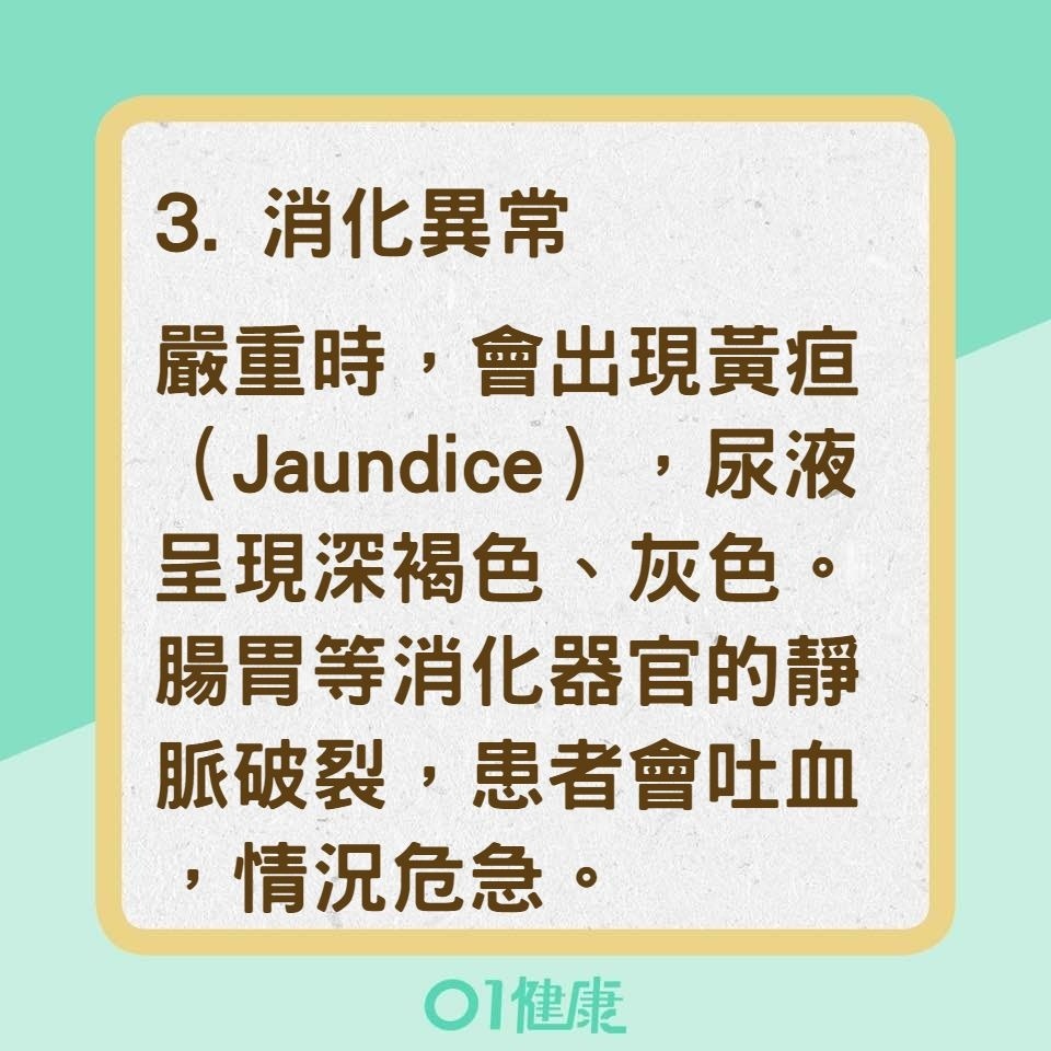 肝病的5種徵兆(01製圖) 肝病的5種徵兆(01製圖)