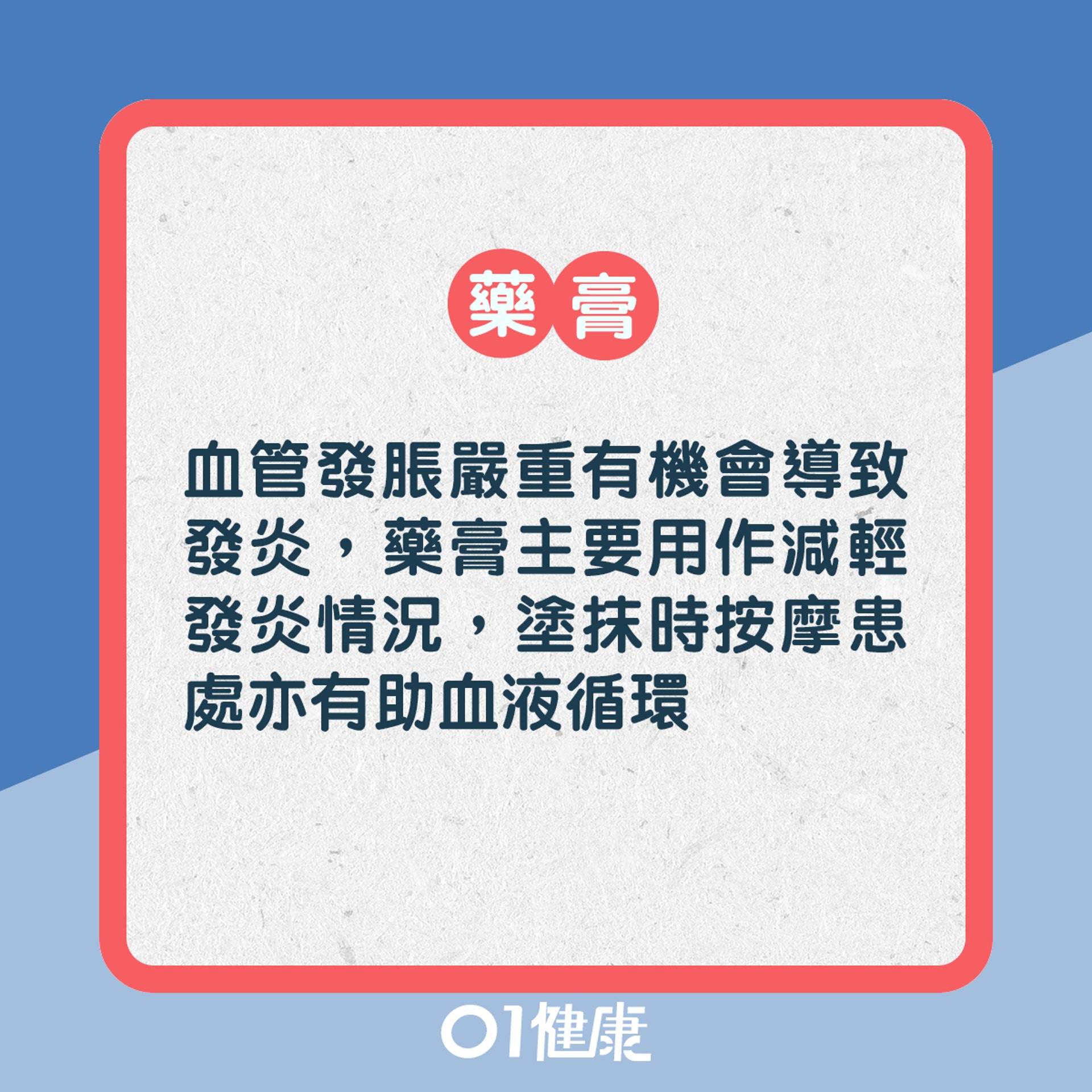 靜脈曲張點治療?(01製圖) 靜脈曲張點治療?(01製圖)