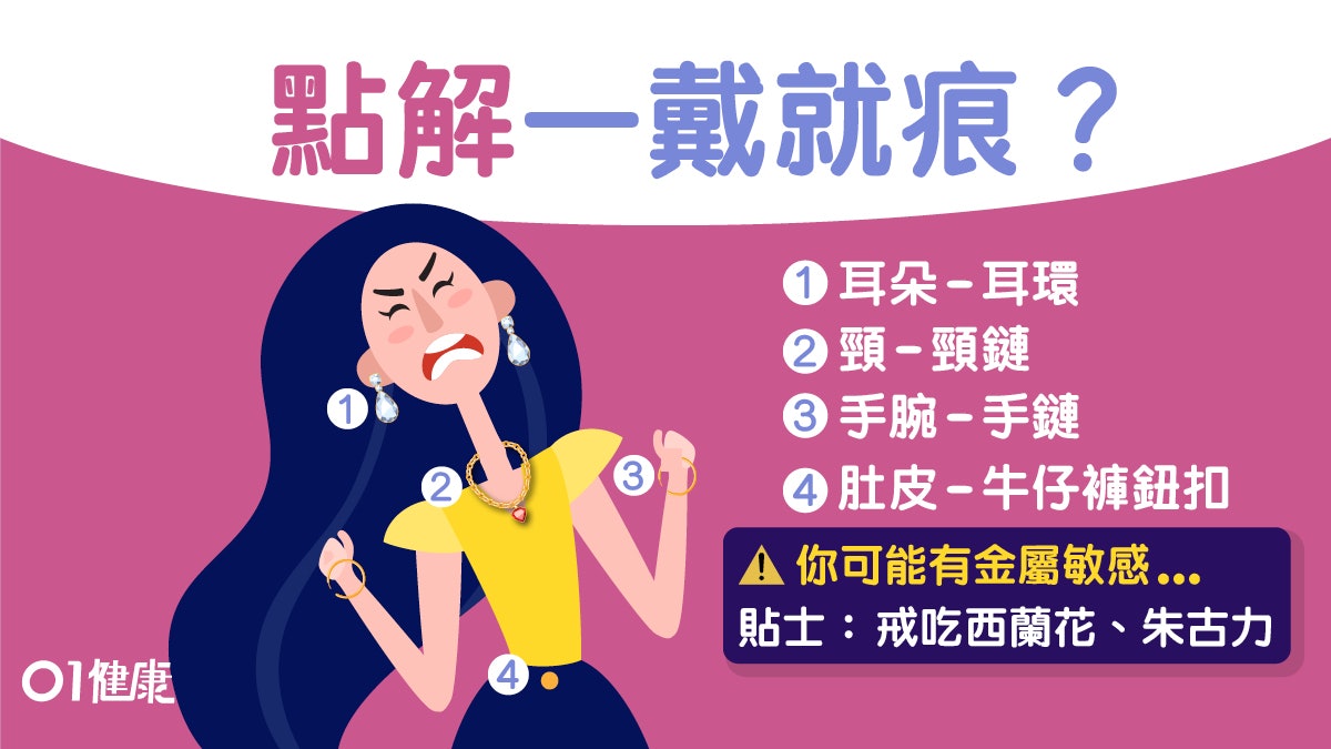 【皮膚敏感】紅疹痕癢或因金屬敏感 4類人士宜少吃西蘭花朱古力 【皮膚敏感】紅疹痕癢或因金屬敏感 4類人士宜少吃西蘭花朱古力