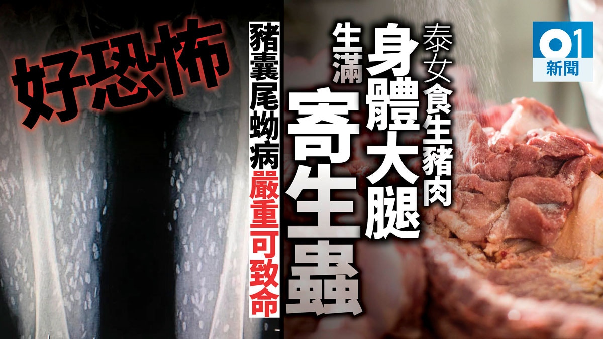 【慎入】泰女吃生豬肉出事　X光照驚現密集白點其實係……