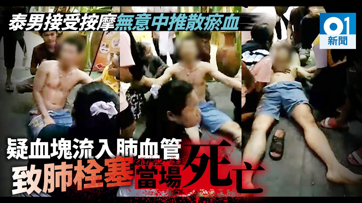 泰式按摩疑「瘀血」推入肺臟血管致栓塞 男子當場死亡 泰式按摩疑「瘀血」推入肺臟血管致栓塞 男子當場死亡