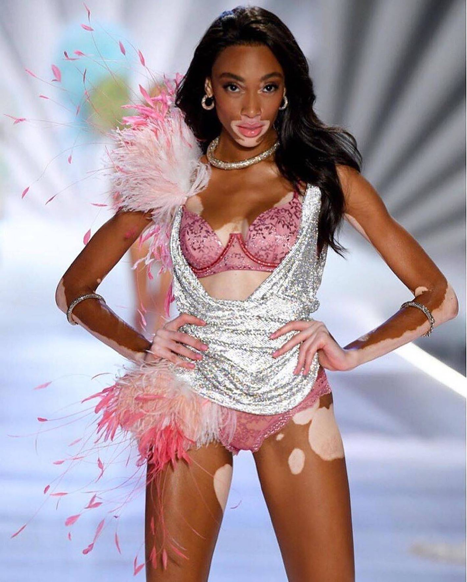 第一位踏上維密台板的白班症模特Winnie Harlow。 第一位踏上維密台板的白班症模特Winnie Harlow。