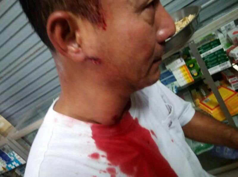 【烏坎衝突】橡膠子彈殺傷力高　烏坎村民讓你看到血淋淋的事實