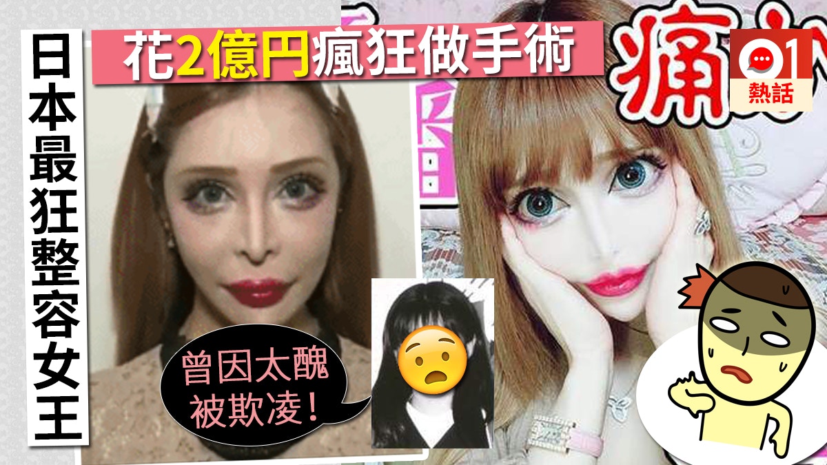 日本最狂整容女王要靚唔要命斥2億円瘋狂做手術稱最痛係隆額 香港01 熱爆話題