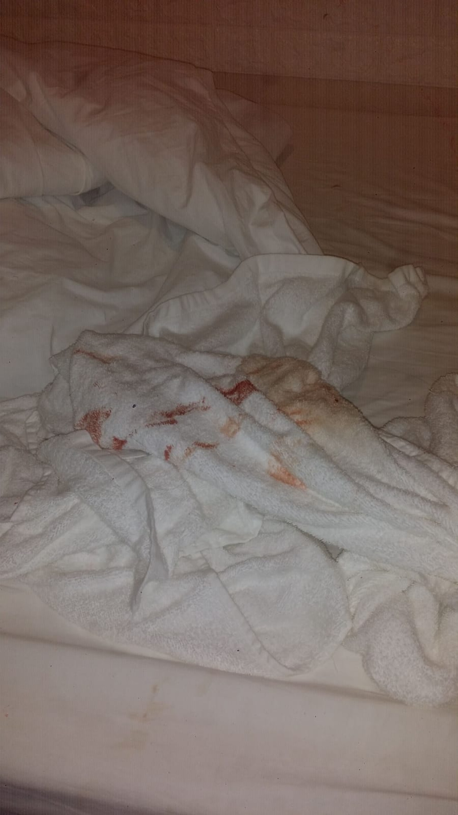 Selena指:「大家以為開時鐘酒店很好玩,其實有時看到如此不衛生的畫面,都幾卻步。」﹙被訪者提供照片﹚ Selena指:「大家以為開時鐘酒店很好玩,其實有時看到如此不衛生的畫面,都幾卻步。」﹙被訪者提供照片﹚