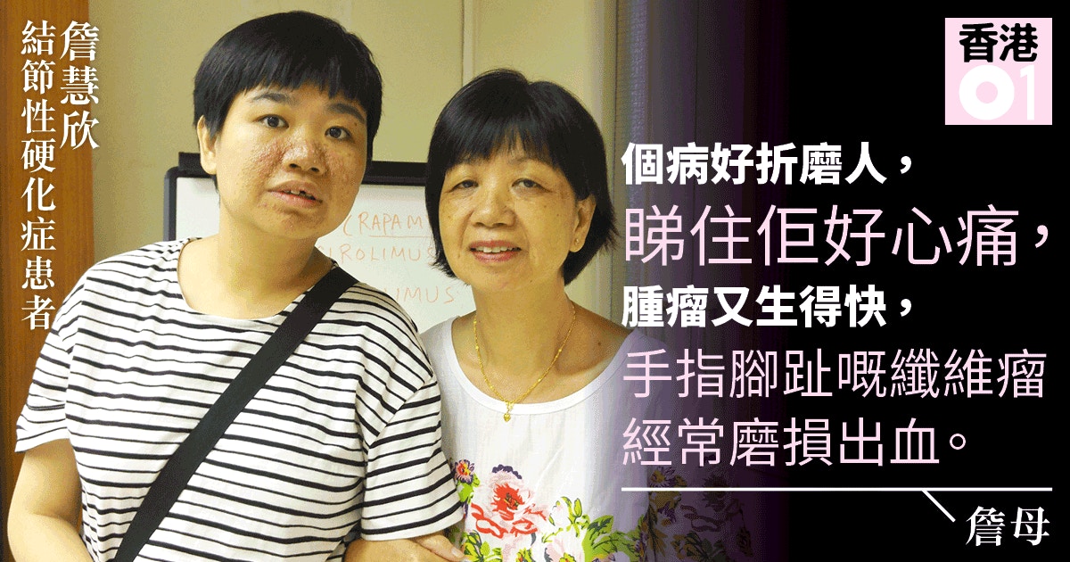 性 硬化 症 結節