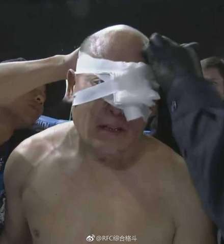 田野上場不足一分鐘就被打傷。（微博）