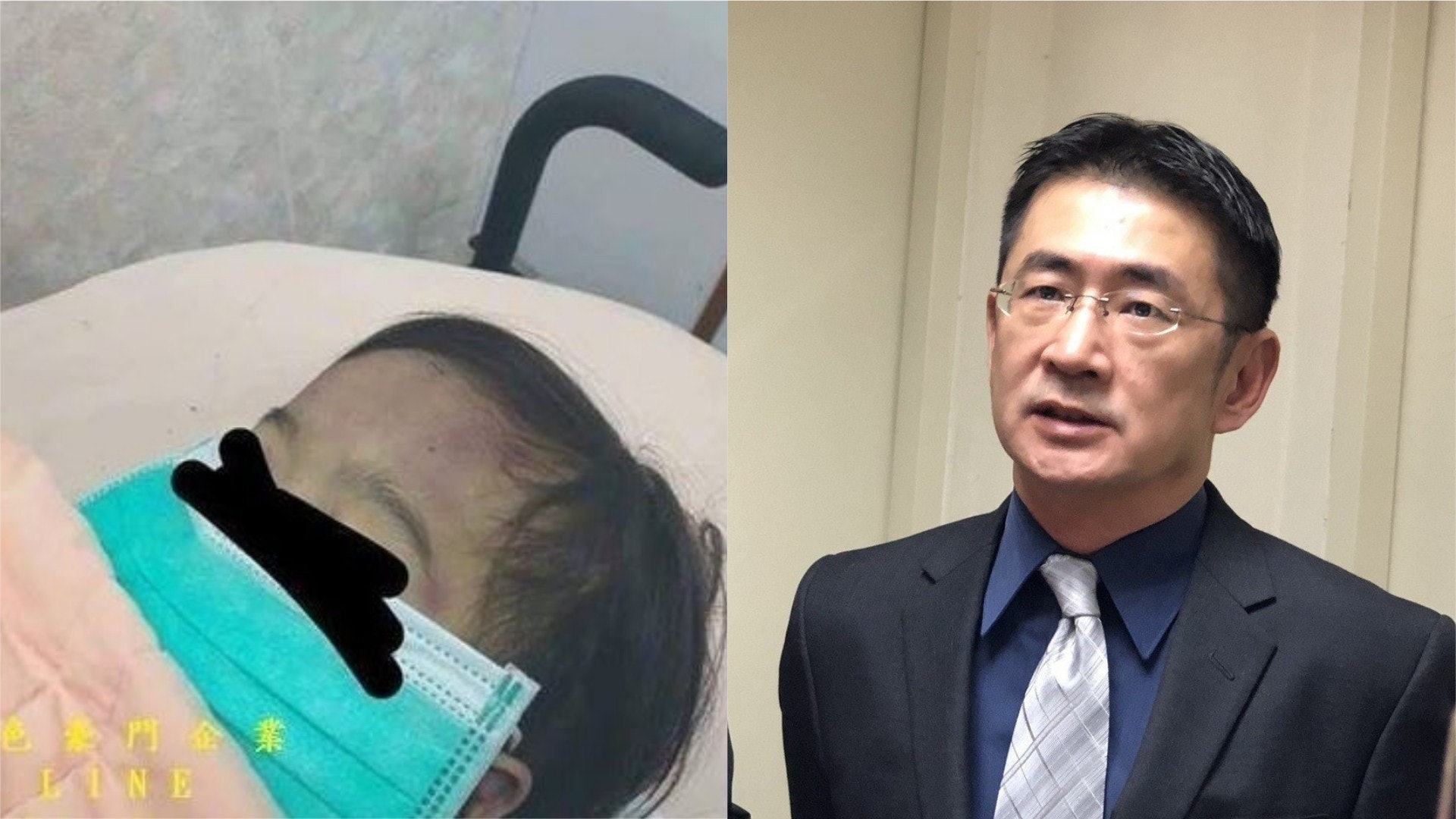 台兩歲童虐打致死 驗屍發現全身新舊傷 疑遭頭撞地板顱內大出血 台兩歲童虐打致死 驗屍發現全身新舊傷 疑遭頭撞地板顱內大出血
