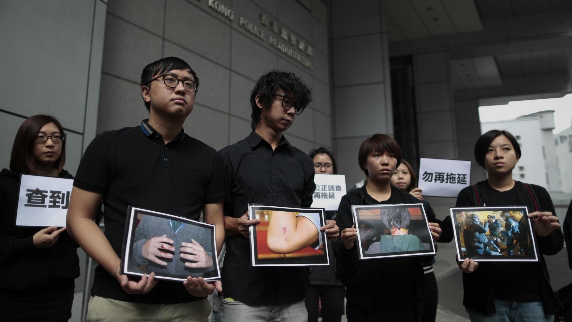 表明採訪仍被打 《明報》前記者指警違《人權法》 入稟索償 表明採訪仍被打 《明報》前記者指警違《人權法》 入稟索償