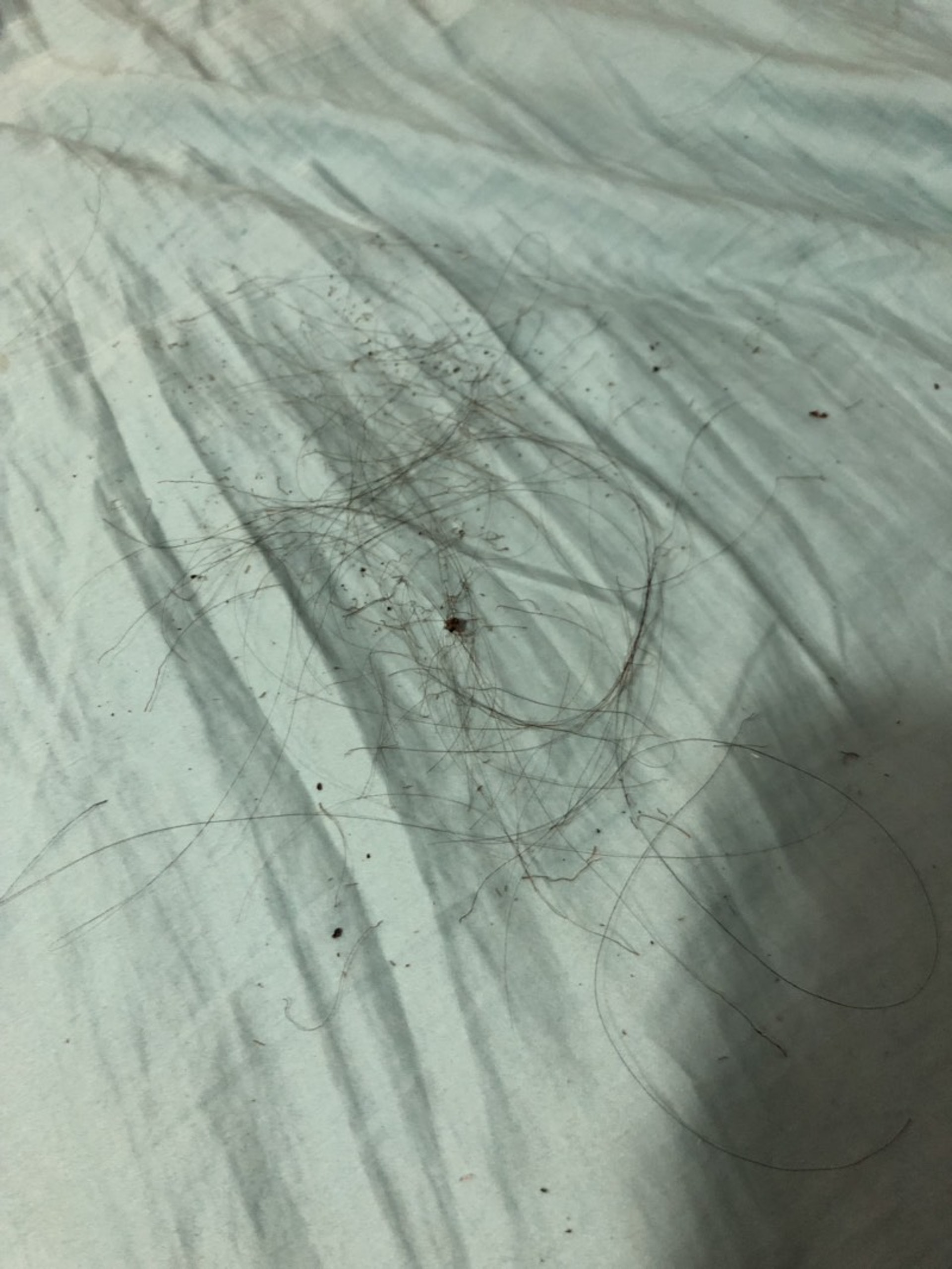 女友不慎燒到自己頭髮,最終自救滅火,但頭髮燒到「崩潰亂甩」。(Dcard討論區圖片) 女友不慎燒到自己頭髮,最終自救滅火,但頭髮燒到「崩潰亂甩」。(Dcard討論區圖片)