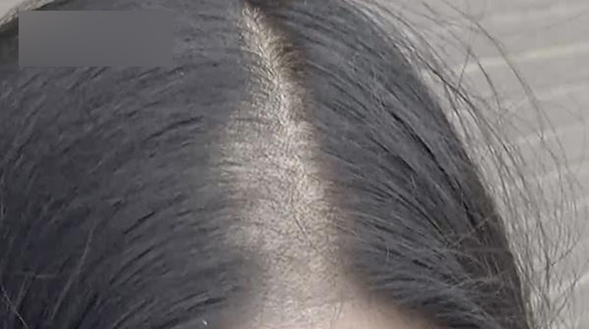 如果分界線好多年都沒變，反而會讓髮際線愈來愈向上移，分界線越來越闊，而且髮根會變得扁塌、髮量變少！（網上圖片）