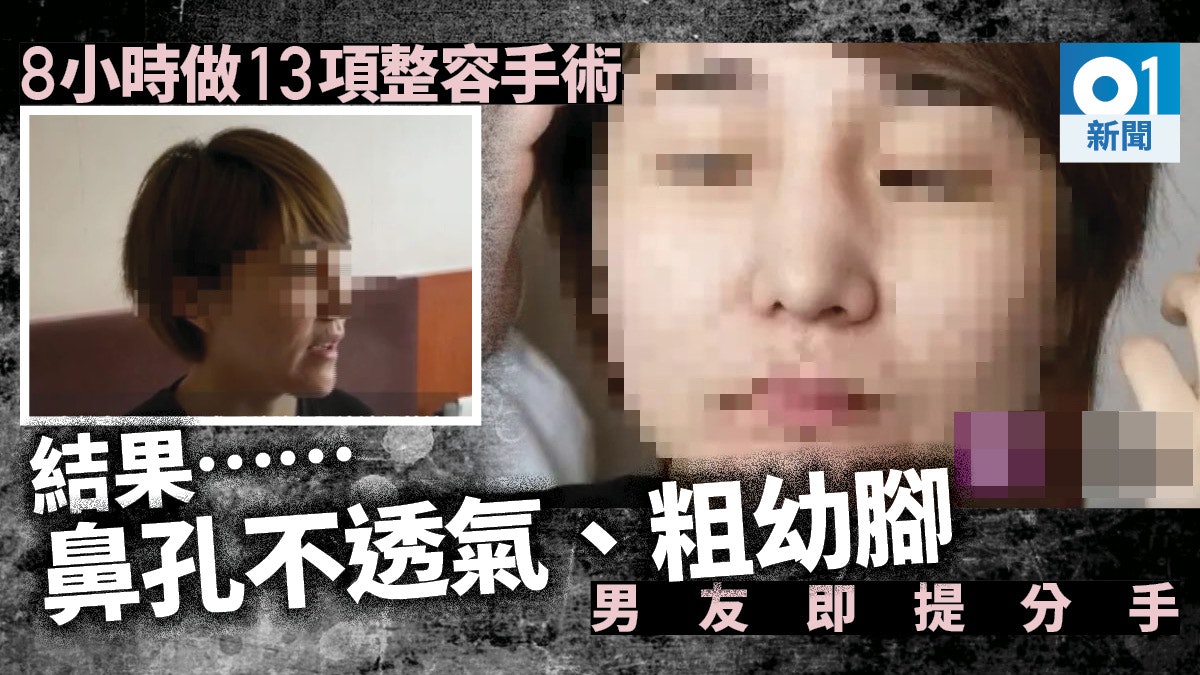 一口氣做13項整容手術後鼻歪變形大細腿25歲女遭狠飛後試圖自殺 一口氣做13項整容手術後鼻歪變形大細腿25歲女遭狠飛後試圖自殺