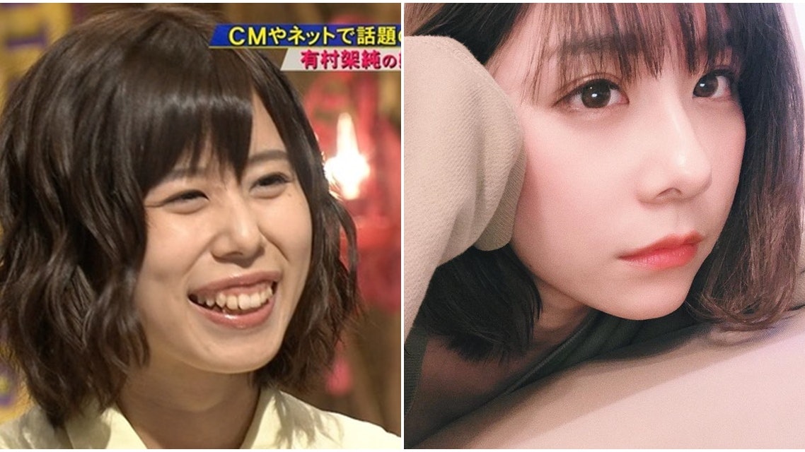 有村架純姊姊兩度整容擺脫 豬扒 稱號上節目公開削骨手術過程 香港01 即時娛樂