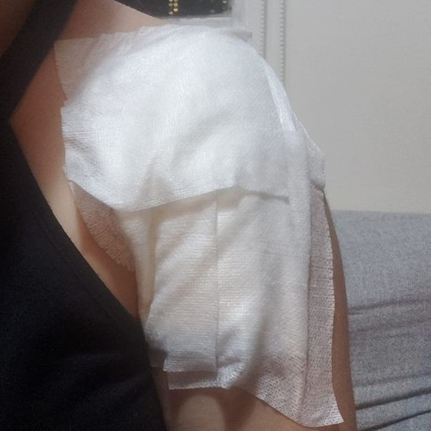 事主於網上張貼受傷情況。(Facebook圖片) 事主於網上張貼受傷情況。(Facebook圖片)