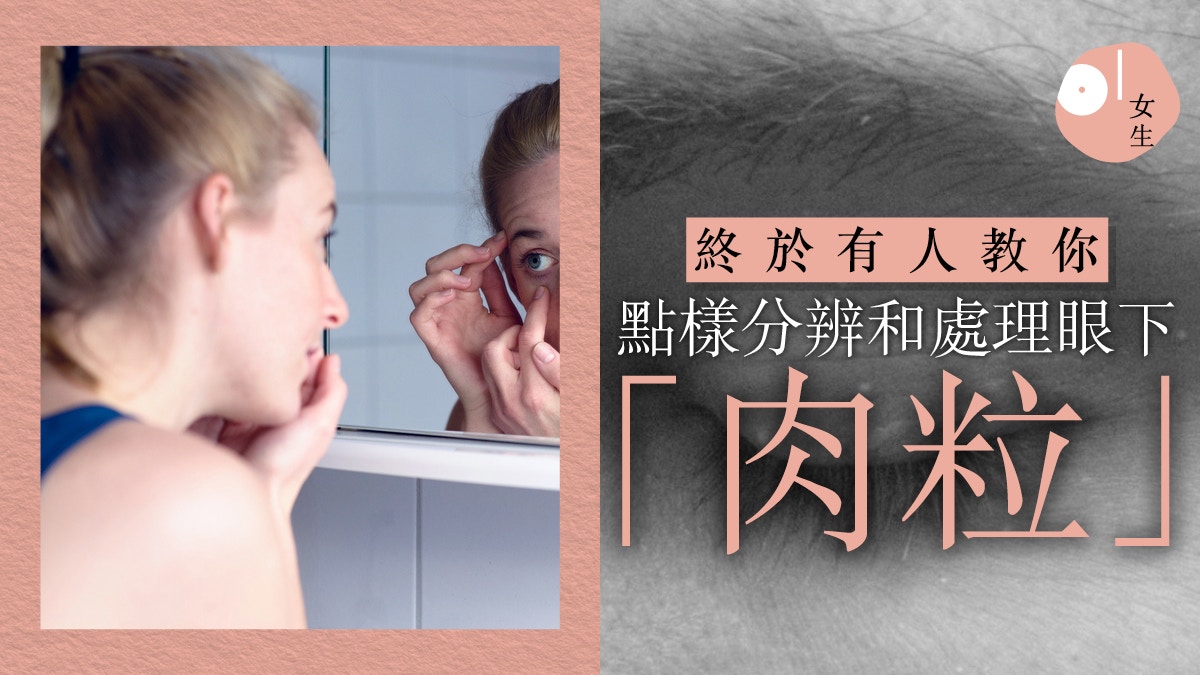 眼下肉粒 眼霜是否油脂粒的主要元兇 想除掉有方法嗎